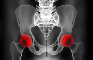 Hip Conditions