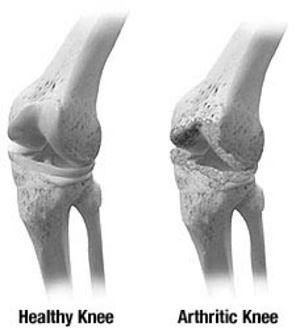 different knees
